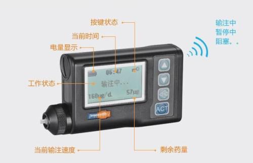 优泵胰岛素泵价格贵吗？优泵胰岛素泵好吗？